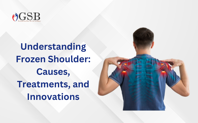 Frozen Shoulder treatment in Delhi